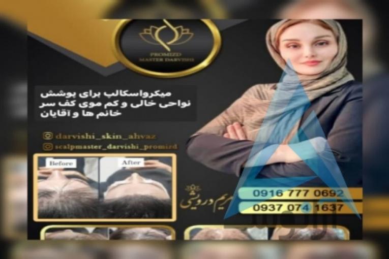میکرواسکالپ سر