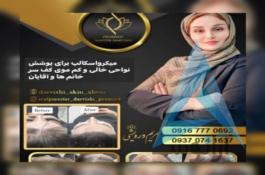 میکرواسکالپ سر